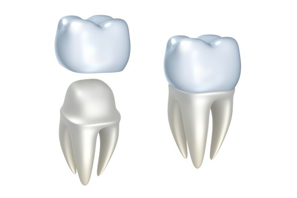 How To Care For Porcelain Crowns