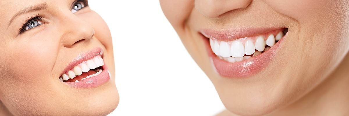 Silver Spring Cosmetic Dentist