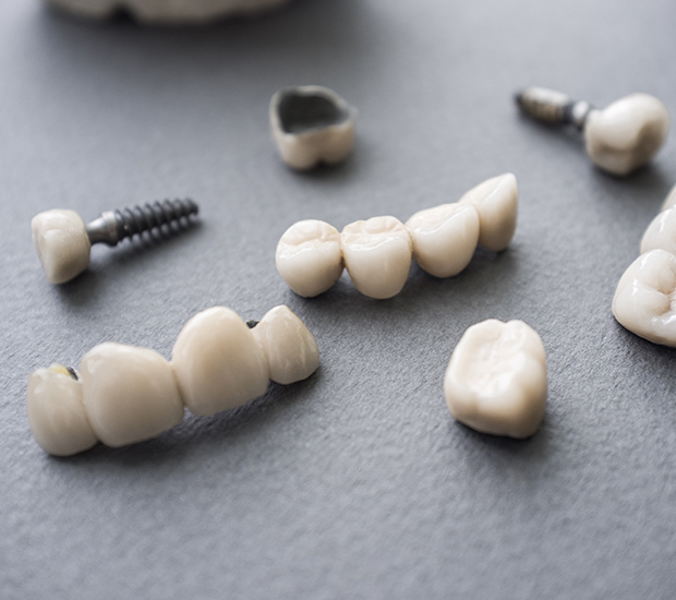 Silver Spring The Difference Between Dental Implants and Mini Dental Implants