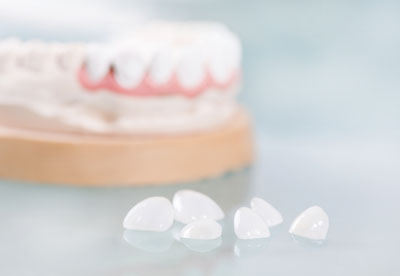 Root Canals and Crowns