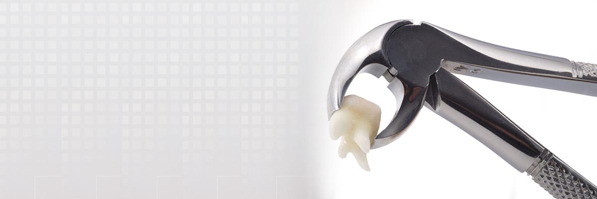 Silver Spring Tooth Extraction